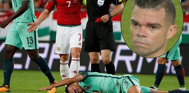 Pepe'den özür dilettiler